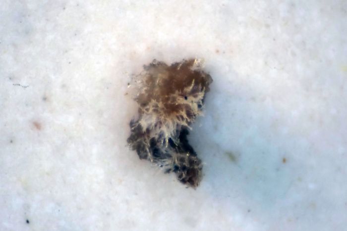 Fungus Pellet 4 Fungus Pellet 4