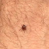 Lone Star Tick