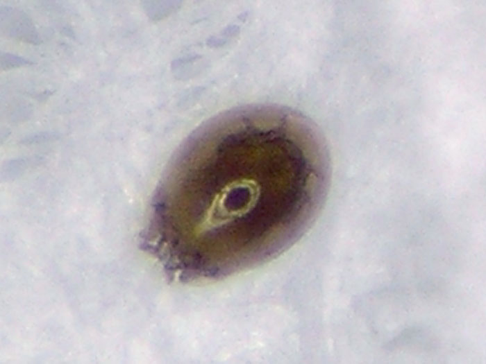 Mite On Gaster Of Ant 4