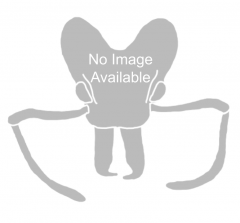 No Image Available